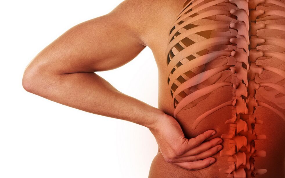 Osteokondroz nedeniyle sırt ağrısı