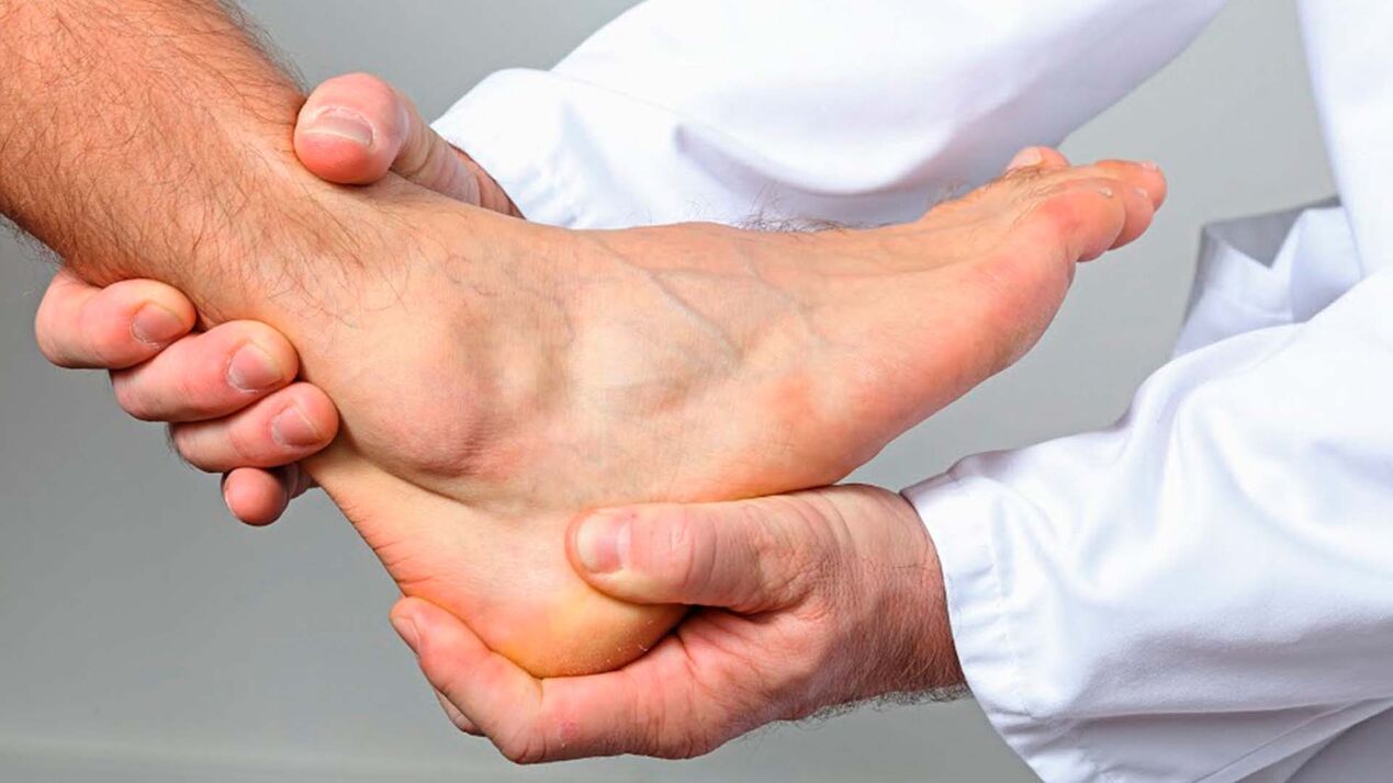 ayak bileği ekleminin artrozu