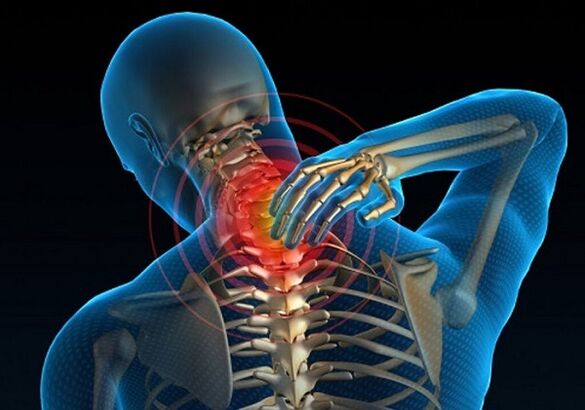 Osteokondroz nedeniyle boyun ağrısı